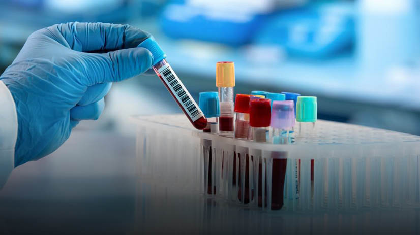 The Science Behind Micronutrient Testing